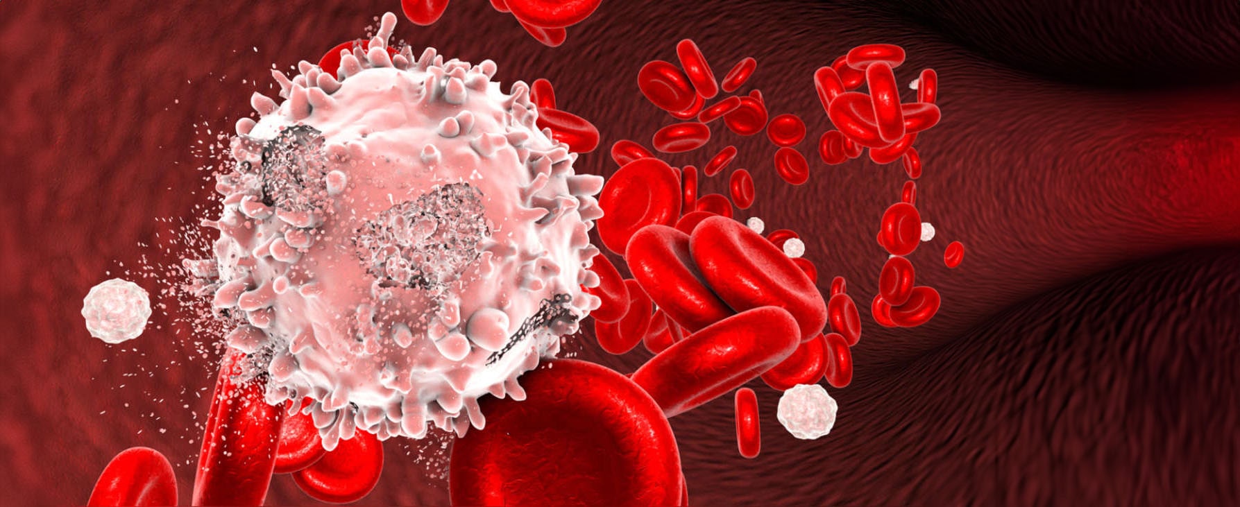 Tratamiento linfomas Guayaquil Dr Cesar Leon-min